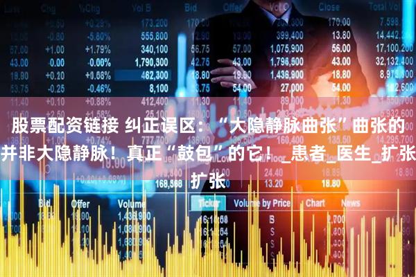 股票配资链接 纠正误区：“大隐静脉曲张”曲张的并非大隐静脉！真正“鼓包”的它！_患者_医生_扩张